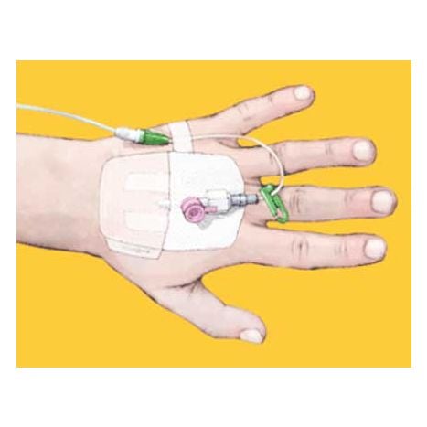 Smith & Nephew 4973 Opsite IV 3000 Dressing 4 in. x 5.5 In. (Each) Preferred Pharmacy Plus Smith & Nephew 4973 Opsite IV 3000 Dressing 4 in. x 5.5 In. (Each) Preferred Pharmacy Plus